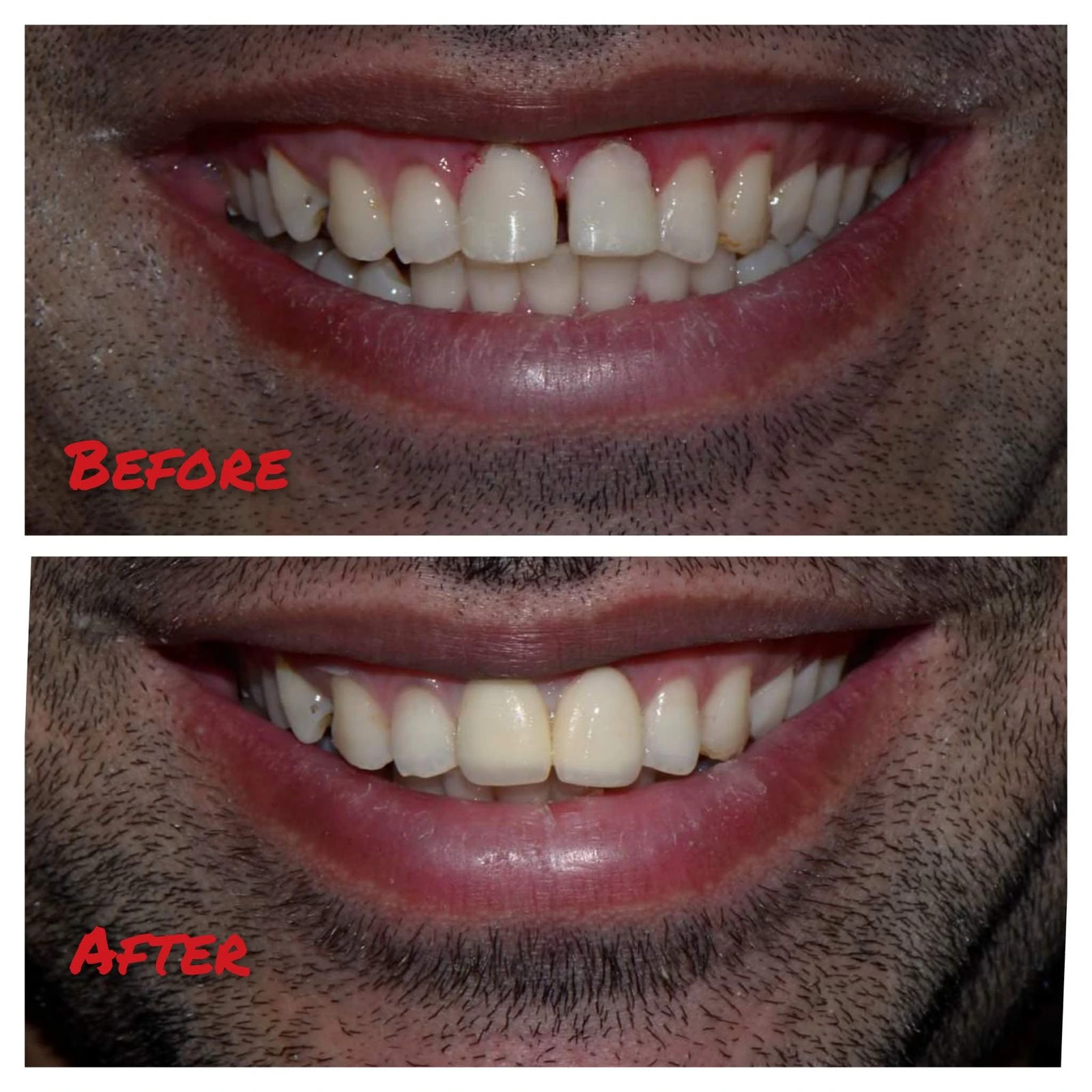 Dental team smiling with patient