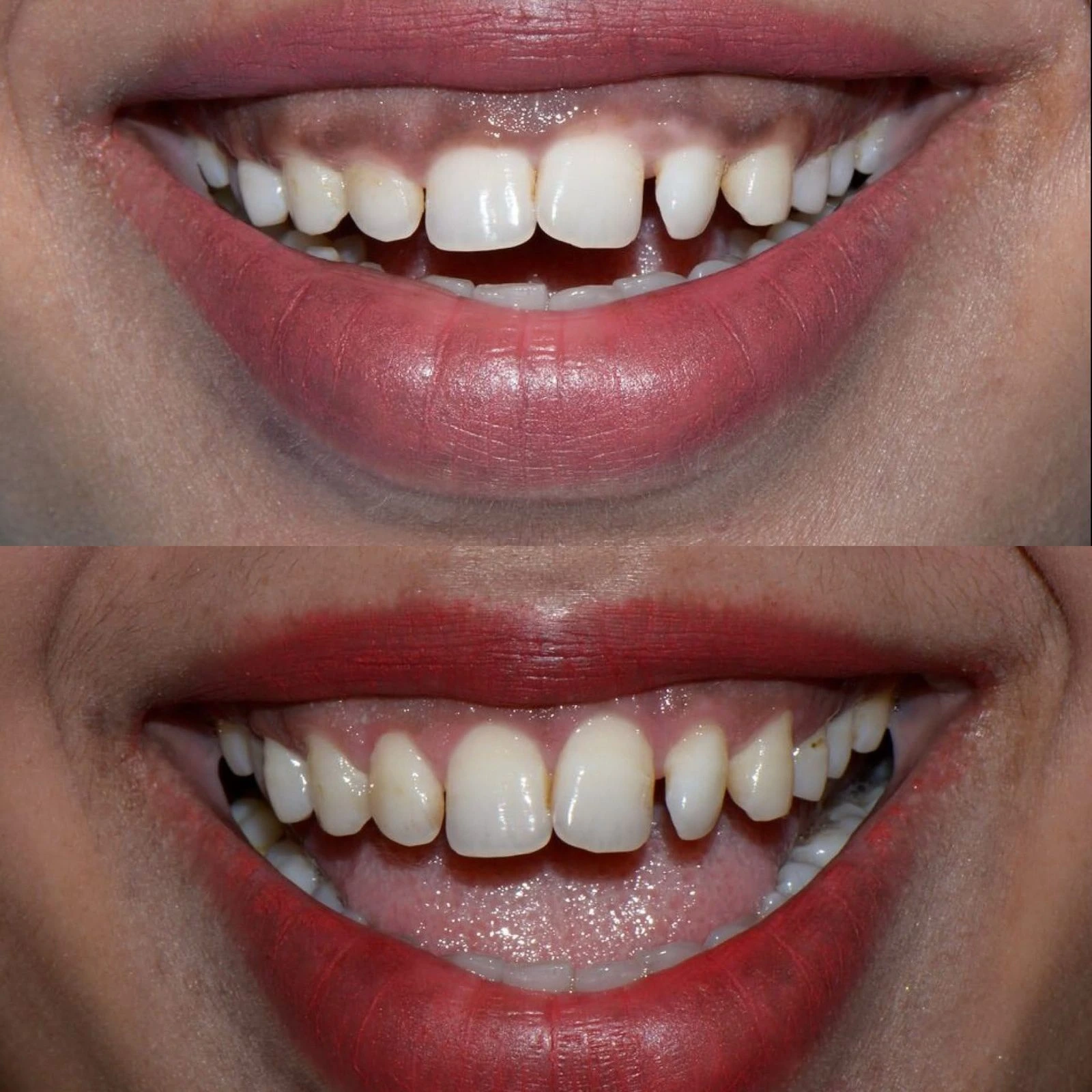 Patient receiving dental care