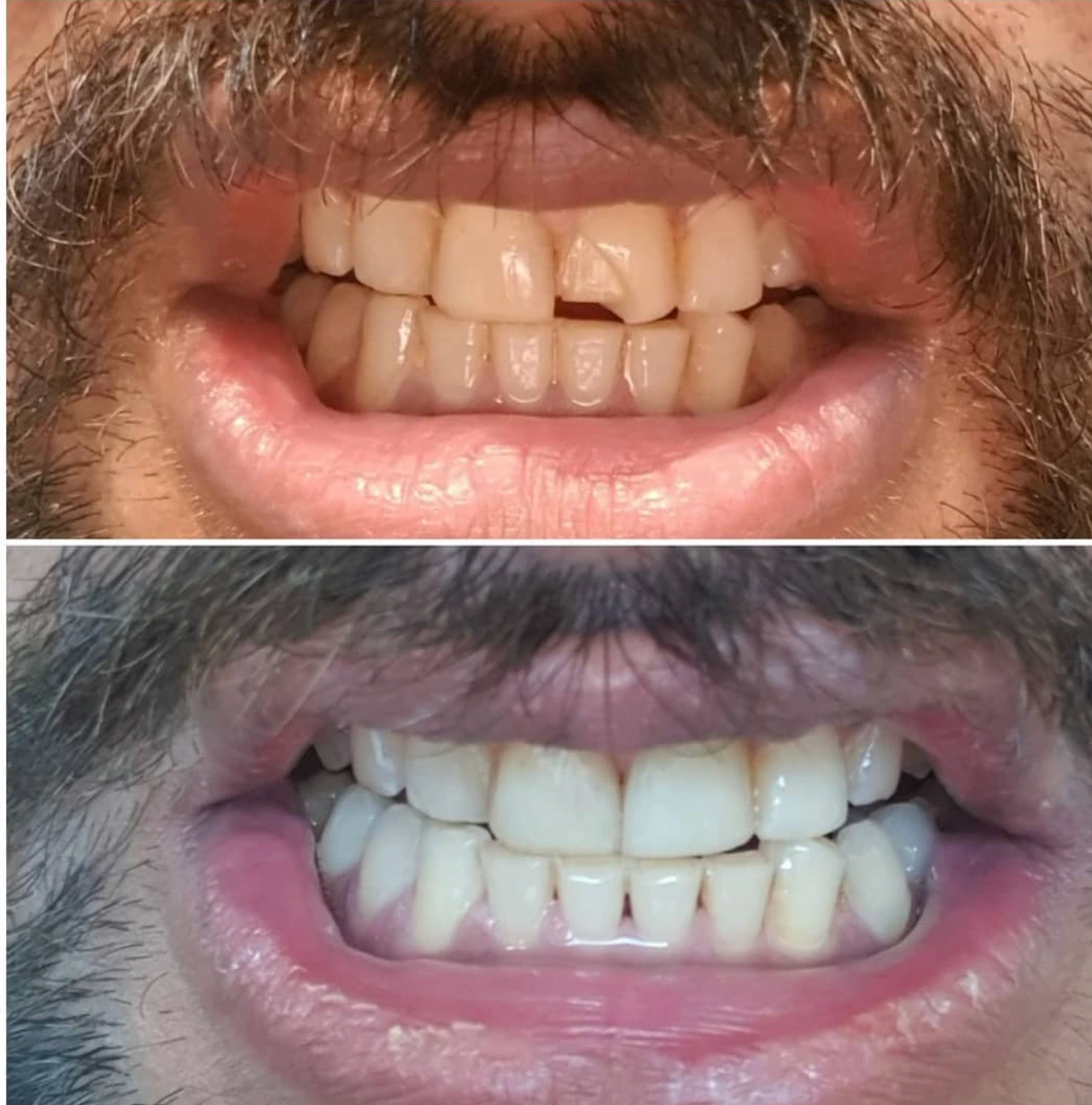 Dental treatment
